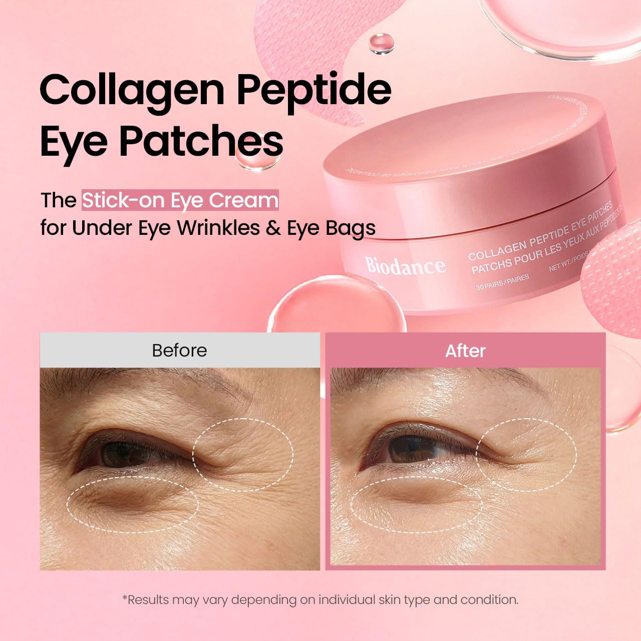 Biodance Caviar PDRN or Collagen peptide eye patches - 60pc